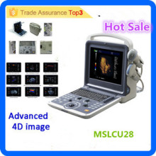 MSLCU28i Gute Auflösung !! Farbe Doppler Ultraschall / 4d Farbe Doppler Ultraschall Maschine / 4d Ultraschall Maschine